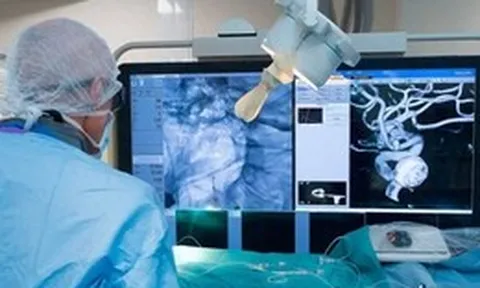 Robot can thiệp mạch máu của Trung Quốc đạt 100% thành công, rút ngắn gần một phần ba thời gian phẫu thuật não