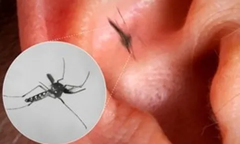 Vì sao muỗi luôn vo ve bên tai con người dù điều đó khiến chúng dễ bị phát hiện và tiêu diệt