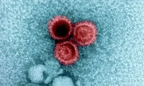 Tại sao một số virus lại tồn tại ở trạng thái ngủ đông trong cơ thể người suốt đời?