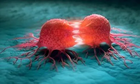 Canada phát triển vi khuẩn “ăn khối u”, mở hướng điều trị ung thư từ bên trong