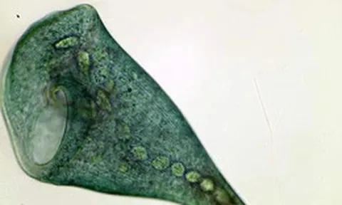 Sinh vật đơn bào Stentor coeruleus chứng minh rằng học hỏi có thể không cần dùng tới não