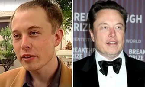 Bệnh hói đầu sắp ”tuyệt chủng” đến nơi: Huyết thanh từ thực vật giúp tóc dày lên 25% chỉ trong 56 ngày