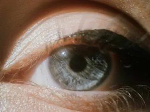 Đến năm 2050, một nửa dân số thế giới sẽ bị cận thị!