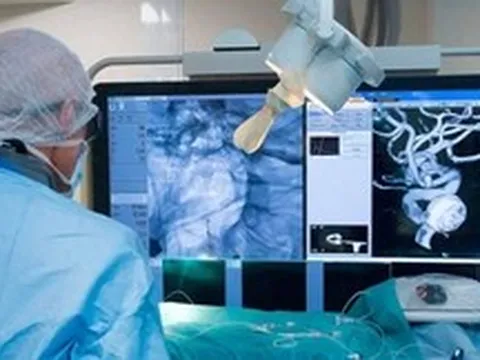 Robot can thiệp mạch máu của Trung Quốc đạt 100% thành công, rút ngắn gần một phần ba thời gian phẫu thuật não