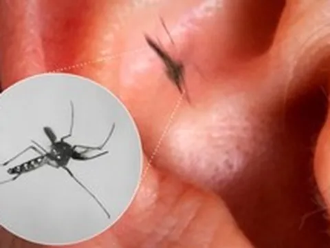 Vì sao muỗi luôn vo ve bên tai con người dù điều đó khiến chúng dễ bị phát hiện và tiêu diệt