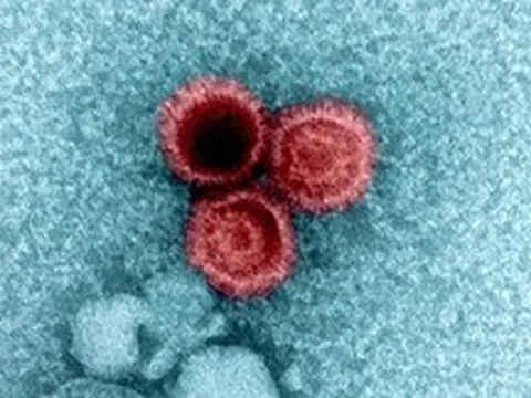 Tại sao một số virus lại tồn tại ở trạng thái ngủ đông trong cơ thể người suốt đời?