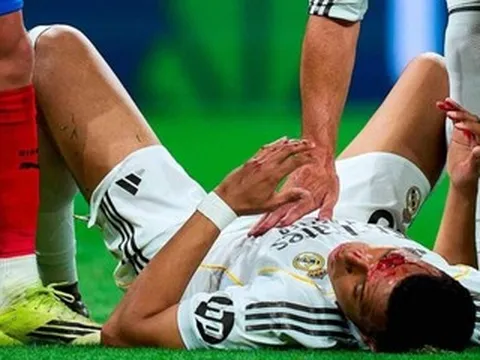 Mbappe đổ máu trên sân, Real Madrid tức giận bị ‘cướp’ phạt đền