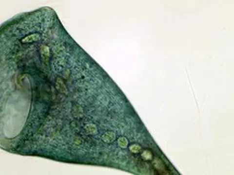 Sinh vật đơn bào Stentor coeruleus chứng minh rằng học hỏi có thể không cần dùng tới não