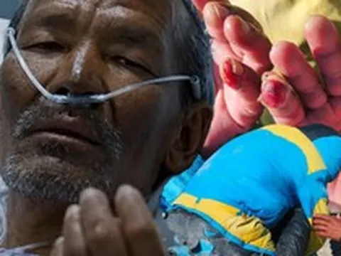 Kỳ tích trên Everest: Người đàn ông sống sót sau 7 ngày mất tích ở "vùng tử thần"