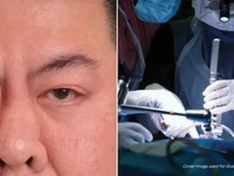 Tin vào mẹo dân gian trên mạng để giải xui khi nháy mắt phải, người đàn ông suýt mù vĩnh viễn vì bị bong võng mạc