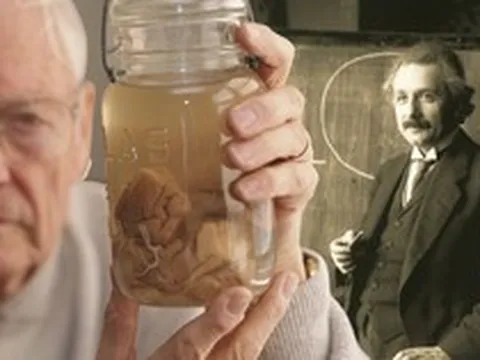 Chuyện gì đã xảy ra với bộ não thiên tài của Albert Einstein sau khi ông qua đời?